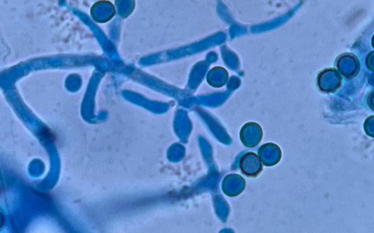 Trichoderma Rhizobacteria